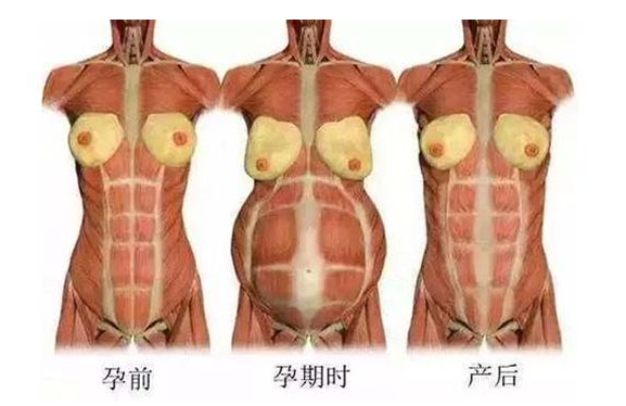 產(chǎn)后媽媽骨盆修復(fù)――帶你回到完美身材！