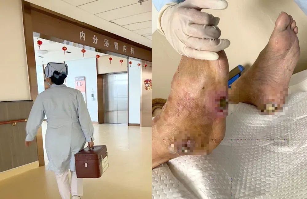 【保山安利醫(yī)院】傷口治療一站式，健康生活零距離！
